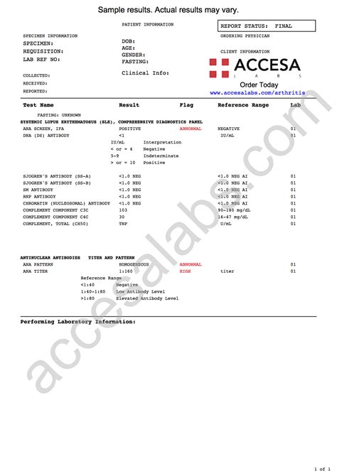 lupus 12 panel quest diagnostics